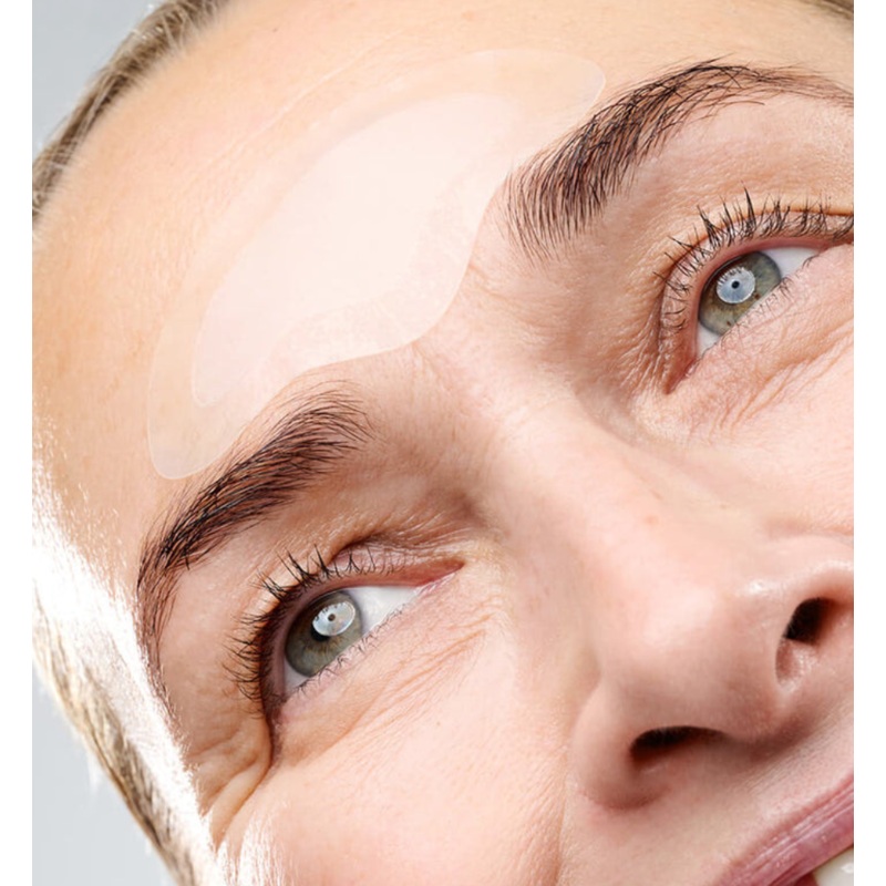 Forehead Microneedling Patch